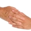 Hand Rejuvenation