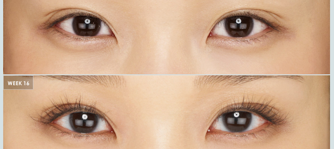 Latisse-charlotte-before-after-1