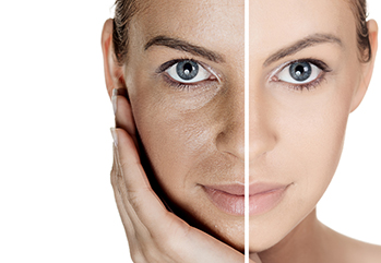 Professional Skin Rejuvenation Programs
