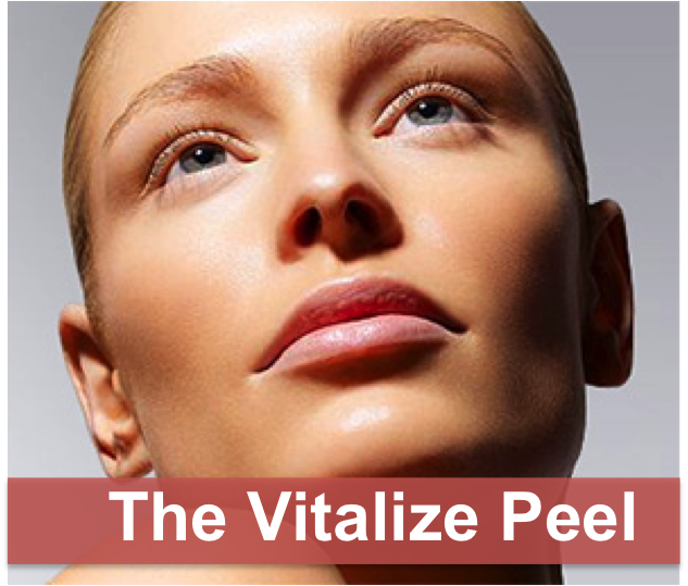 Vitalize Peel In Charlotte Nc