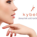 Kybella Charlotte Nc 1